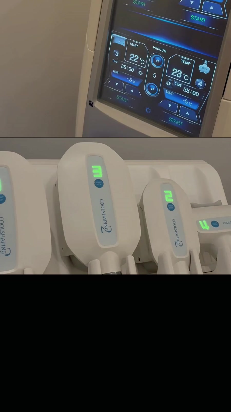 Inside a fat-freezing visit. Video still from Defined Aesthetics.