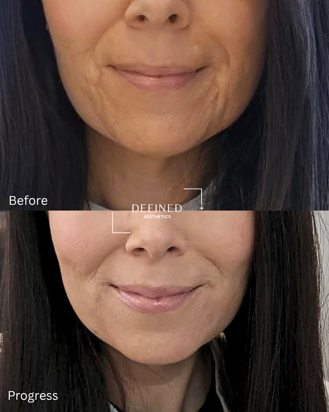 Face · skin rejuvenation — original before-and-progress photographs